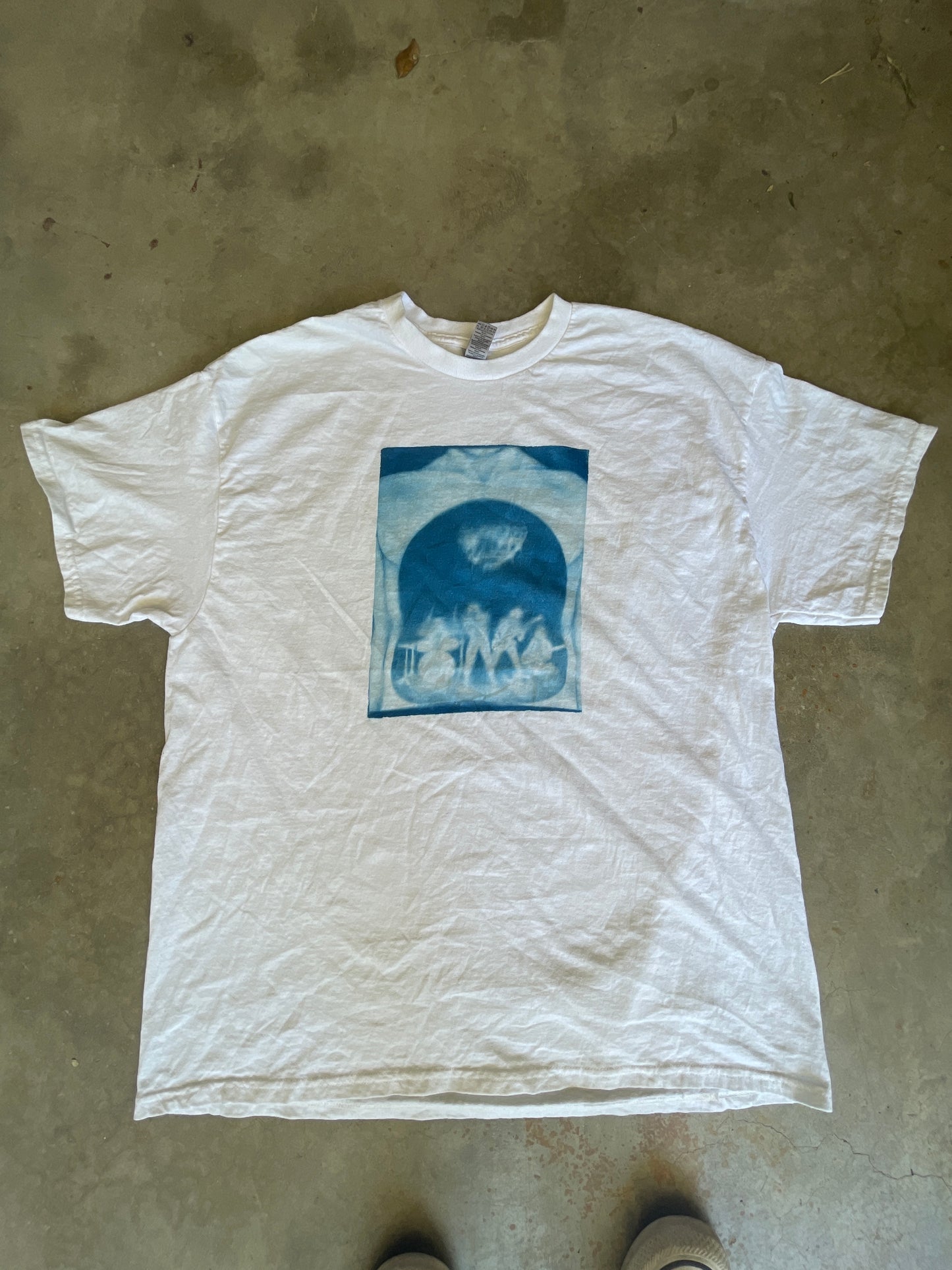 Stomach Band Misprint