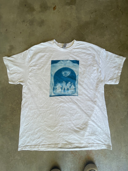 Stomach Band Misprint
